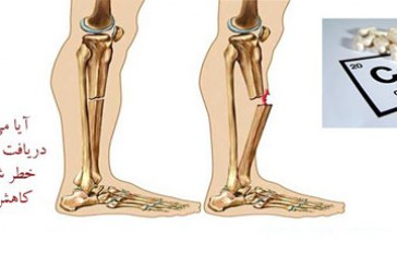 دریافت کلسیم بیشتر، خطر شکستگی را کاهش نمی دهد