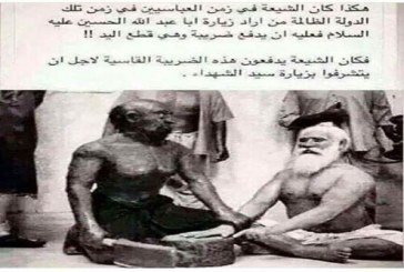 زیارت بارگاه امام حسین(ع) در قبال قطع دست !