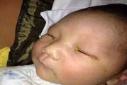هشدار/فلش دوربین نوزاد سه ماهه را کور کرد!
